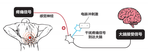 【ZE科普】一樣是電，為什么名字如此花哨