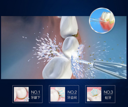 光靠刷牙解決不了牙齒困擾！沖牙器排行榜幫助你