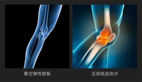 小米眾籌首款智能折疊跑步機來襲，讓愛跑步的人有“地”放矢