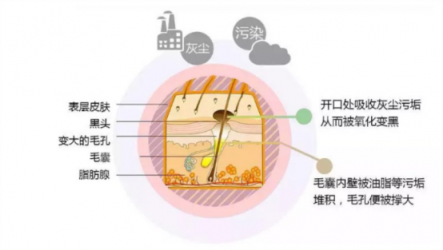 讓你的黑頭全退散！黑頭儀有用嗎？