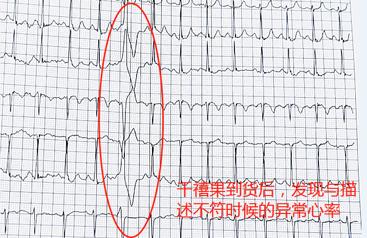 618網(wǎng)購(gòu)致老人多次心率異常 ?醫(yī)生提示要選有保障的網(wǎng)購(gòu)平臺(tái)