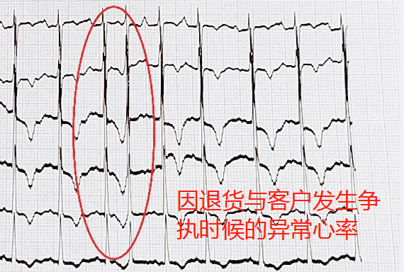 618網(wǎng)購(gòu)致老人多次心率異常 ?醫(yī)生提示要選有保障的網(wǎng)購(gòu)平臺(tái)