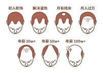 2.5億人被脫發(fā)困擾？Rogaine培健實力生發(fā)