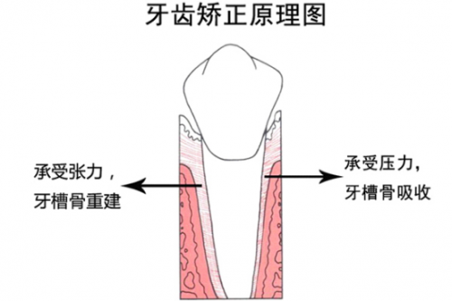 3D數(shù)字化模型矯牙“神器”，讓你不懼年齡“矯”傲逆襲