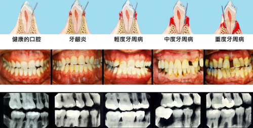 8月5日小米有品眾籌！素諾智能可視沖牙器C3 pro倒計(jì)時(shí)海報(bào)曝光