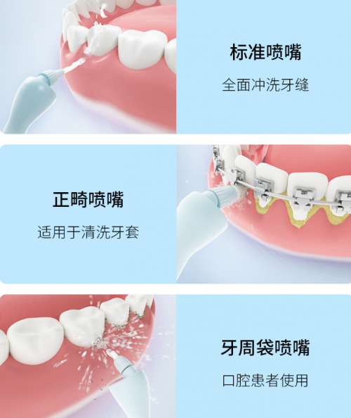 正畸人士福音！素諾智能可視沖牙器C3 pro看得清，沖得凈