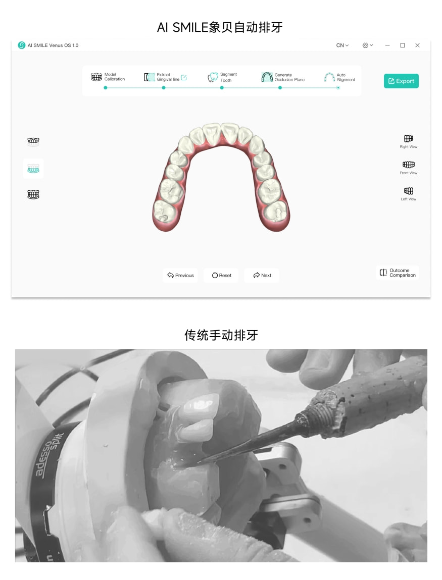 獨角獸地位盡顯！象貝AI正畸排牙系統(tǒng)Venus1.0發(fā)布 開辟數(shù)字化牙科新紀(jì)元