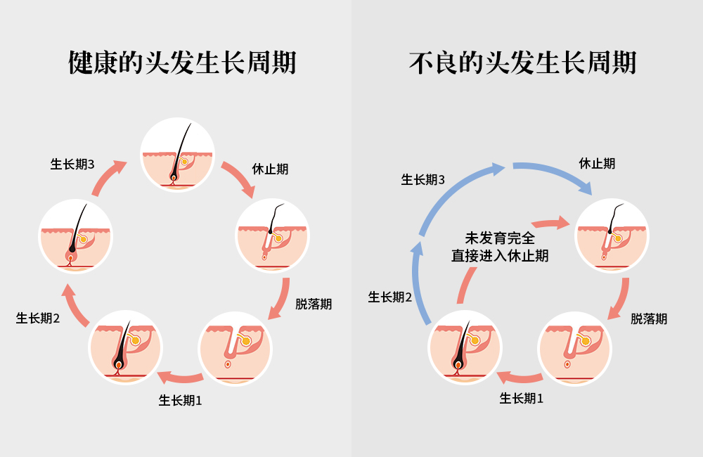 拯救頭頂大事，采用創(chuàng)新配方REDENICAL的DR ZERO來(lái)到中國(guó)