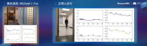 騰訊醫(yī)療人工智能研究院院長(zhǎng)范偉：超越認(rèn)知，AI重塑運(yùn)動(dòng)評(píng)估