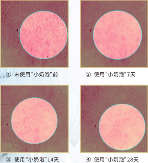 美內(nèi)“小奶泡”，最簡單的潔面產(chǎn)品你選對了嗎？