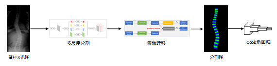 斬獲2019 MICCAI AASCE第一，騰訊優(yōu)圖醫(yī)療AI再獲突破