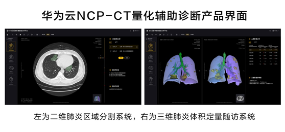 華為云推出新冠肺炎AI輔助診斷服務(wù)，疫情期間免費對定點收治醫(yī)院開放