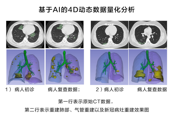 華為云推出新冠肺炎AI輔助診斷服務(wù)，疫情期間免費對定點收治醫(yī)院開放