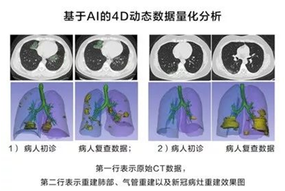 非常時(shí)期下的城市防控、生產(chǎn)與治理，華為云用AI“全鏈條“戰(zhàn)疫