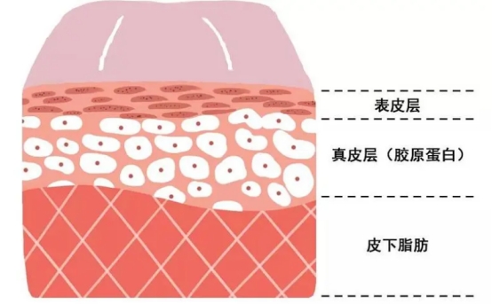 不做表面功夫，潤致娃娃針+分層抗衰讓你年齡滿40減20